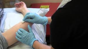 Work out how you will pay for nexplanon. How Does The Contraceptive Implant Work
