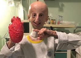 Real Life Benjamin Button Becomes Scientist And Looks For The Cure For Premature Aging Texto Em Ingles Com Audio