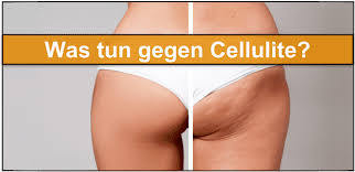 cellulite ᐅ ursachen und losung 10 sofort tipps gegen cellulite