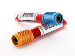 Check spelling or type a new query. Partial Thromboplastin Time Ptt Test Purpose And Procedure