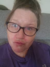 Darcy pouts her lips like a duck. Not pretty!