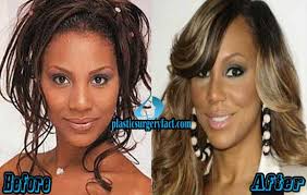 Tamar braxton unveils botched plastic surgery in new tiktok video. Tamar Braxton Plastic Surgery Before And After Photos Plastic Surgery Facts