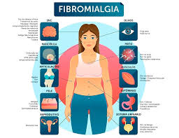 A dor e a falta de sono associadas à fibromialgia podem interferir na sua capacidade de funcionar em casa ou no trabalho. Voce Ja Ouviu Falar De Fibromialgia