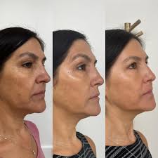 Michelle Lora (@aesthetics_nj) • Instagram photos and videos