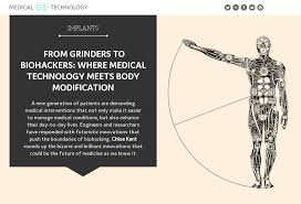 Download body modification amino apk 3.4.33514 for android. From Grinders To Biohackers Where Medical Technology Meets Body Modification Medical Technology Issue 23 January 2020