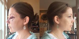 On a Personal Note: What Happened to My Face