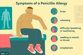 children and penicillin allergic reactions