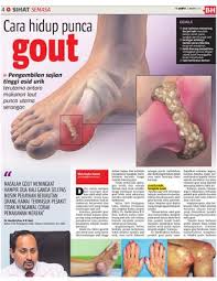 Makanan beralkali untuk pesakit gout. Bagaimana Penyakit Gout Boleh Menyerang Hingga Berlaku Kematian Zul Muhammad