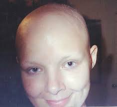 Welcome to Team Amy's Fundraising Page