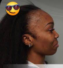 What hair concerns do you have or are wondering about?