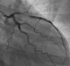 Echocardiogram – Part 3: Types Of Heart Scan