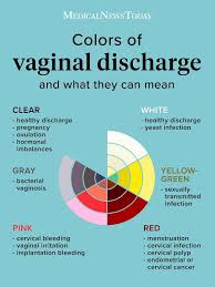 Everything seems to be going alright until you notice a light pink discharge staining your panties halfway through your cycle. Vaginal Discharge Color Guide Causes And When To See A Doctor