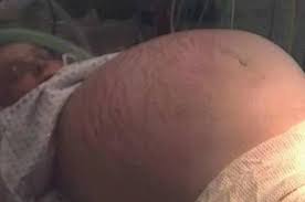 Okey jom kita bincang apa itu cyst. Tanda Tanda Cyst Ovari Jika Ada Tanda Ini Segera Jumpa Doktor Theasianparent Malaysia