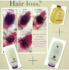 Sac Dokulmesine Son Sacdokulmesi Hairlost Bitkisel Pozitifteam Forever Living Aloe Vera Forever Products Forever Living Products