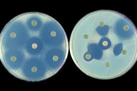 Check spelling or type a new query. Antibiotiques Quand Les Bacteries Font De La Resistance L Actu De L Institut Pasteur