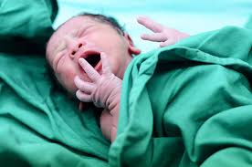 Check spelling or type a new query. Ketahui 5 Penyebab Mulut Kering Pada Bayi Yang Baru Lahir