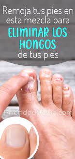 Remoja Tus Pies En Esta Mezcla Para Eliminar Los Hongos De Tus Pies Body Skin Condition And Treatment Beauty Treatments Beauty Care