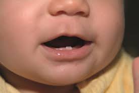 Yeah it takes at least a month for the tooth to fully emerge once it cuts.some take even longer. Tooth Eruption And Teething In Children The Pharmaceutical Journal