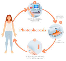 Opportunity of the unlimited period of storage. Biotherapy Photopheresis Cell Culture Bio Banking Cord Blood