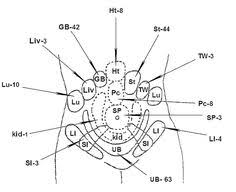 64 Best Abdominal Acupuncture Images In 2019 Acupuncture