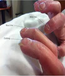 Image result for Mees Line