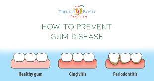 How To Prevent Gum Disease - Friendly Family Dentistry