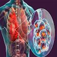 Chest Infection product image