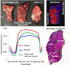 He referred to a number of studies that indicate the rate of reoccurance of positive margins in a partial with a tumor like mine doesn't necessarily mean the cancer will return. Label Free Hsi For Surgical Margin Assessment Quantitative Bioimaging Laboratory