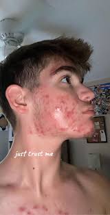 David DiDonato (@y0.david)