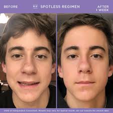 Rodan + Fields with Christine Hammond