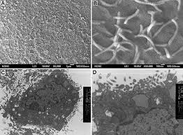 We did not find results for: Scielo Brasil Primary Cultures Of Mouse Small Intestinal Epithelial Cells Using The Dissociating Enzyme Type I Collagenase And Hyaluronidase Primary Cultures Of Mouse Small Intestinal Epithelial Cells Using The Dissociating