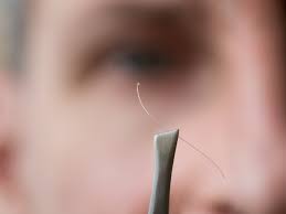 Neither did it stop my hair from falling off. Random Long White Thick Hair Strings Skin Hair Problems Medical Answers Body Health Conditions Center Steadyhealth Com