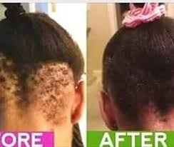 Stop Buying Fake Chebe Powder And Karkar Oil That Won T Work In Stock Is Your 10 Stop Buying Fake Chebe Thick Hair Remedies Help Hair Loss Balding Remedies