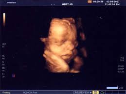 Maybe you would like to learn more about one of these? Ecografias En El Embarazo Ecografias 2d Y 3d 4d Papaenapuros Com