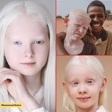 images?q=tbn:ANd9GcRW3R0j7eQlil1PU1oNiehf6dYxCJMaj33cTQ&s