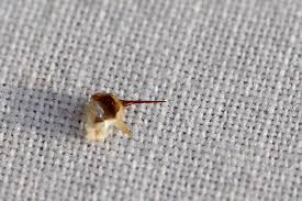 ‟mix one part dish soap to four parts water in a spray bottle. Honeybees Die After Stinging Why Earth Earthsky