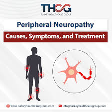 Image result for Peripheral Neuropathy