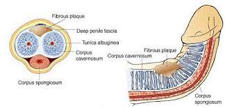 Peyronie S Disease Specialist In Greater Washington Dc Northern Virginia