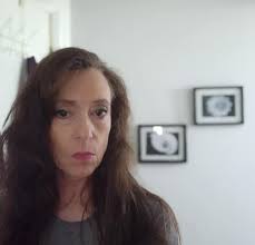 Hello, I completed the Tepezza treatments almost two years ago and now I  have noticed my bulging and swelling is back, along with dry eye and all  the symptoms....I feel so defeated