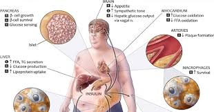 This Is What Happens To Your Waistline When You Drink Diet Soda Diet Soda Diet Soda Dangers Drinks For Bloating