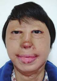 Plastic and Reconstructive Surgery®