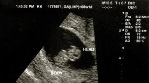 Image result for Ultrasound
