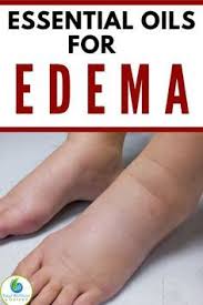 Pin By Esther Contreras On Health Herbal Essential Oils Essential Oils For Skin Essential Oils Health