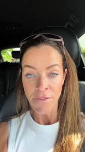 My Disappointing Botox Experience: A Candid Review