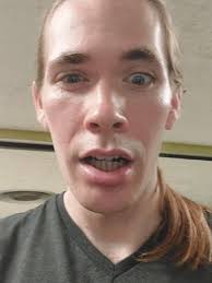 What Happen to Harold Estroesta