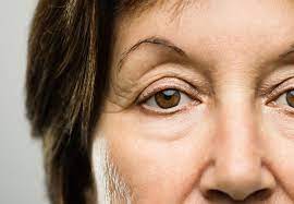 Maybe you would like to learn more about one of these? The Best Options For Droopy Eyelids Circles And Sags Health Essentials From Cleveland Clinic