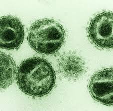 The virus then spreads from human to human by contact with an infected person's body. Infektionskrankheiten Touristin Stirbt An Gefahrlichem Marburg Virus Welt