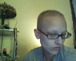 hair growth 3 weeks post chemo 2