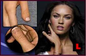 I'm 55 and i still get teased about how short and stubby my thumbs are. 10 Celebrities With Strange Physical Flaws Listverse