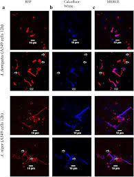 The company's web site is usually a great way to do this. Expression Profile Analysis Reveals That Aspergillus Fumigatus But Not Aspergillus Niger Makes Type Ii Epithelial Lung Cells Less Immunological Alert Bmc Genomics Full Text